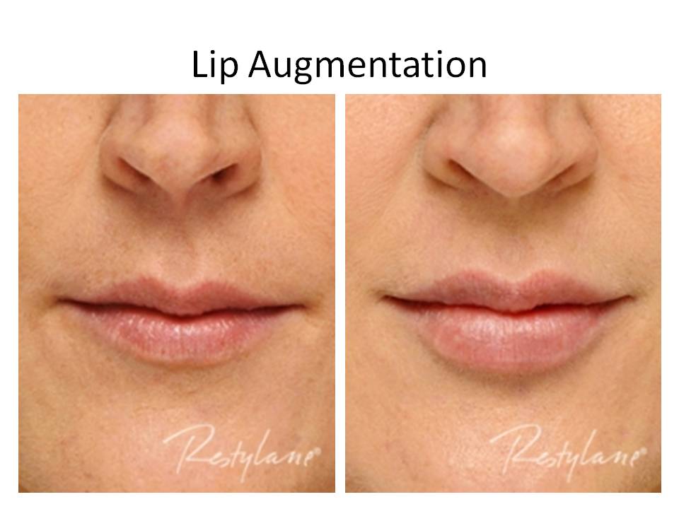 Before & After Cardiff Skin Care Clinic Cardiff